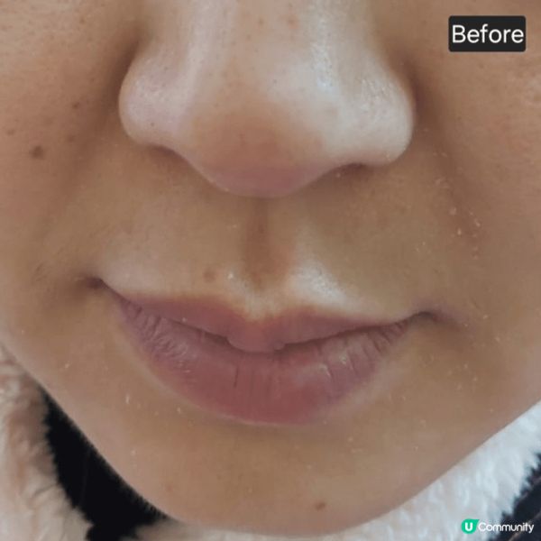 麗珠蘭是韓文中的「水光針」的意思，這是一種最新的塗抹式護膚產...