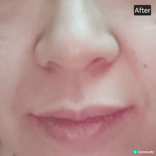 麗珠蘭是韓文中的「水光針」的意思，這是一種最新的塗抹式護膚產...