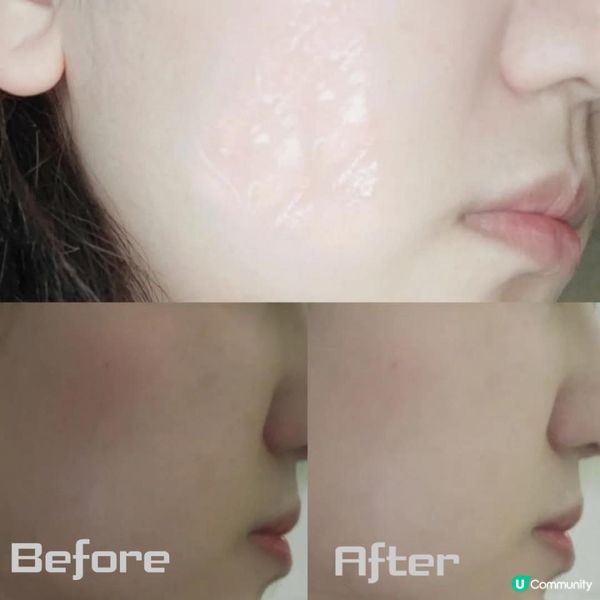 🌿 7秒鎮靜保濕精華 | 🌿 Cica Teatree Calming Serum 🌿