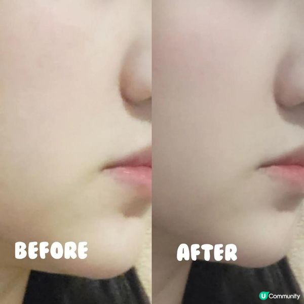 🌟INFYNYTI HIFU 小顏拉提緊致凍膜 300ml 🌟