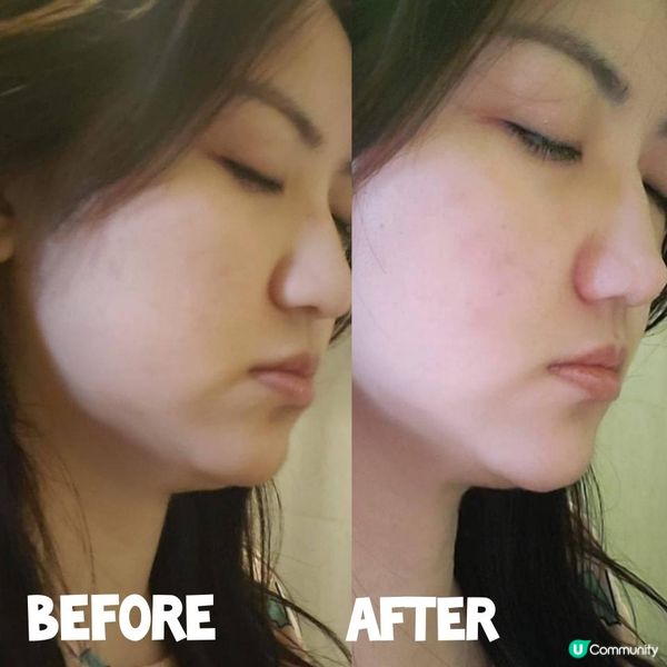 🧴Purlés 注氧保濕系列 | 高效鎮靜保濕