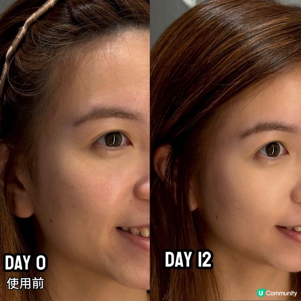 【⁠Meditherapy | 毛孔保養嘅微毛孔系列】