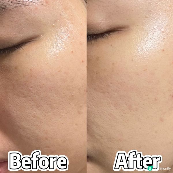 麗珠蘭舒敏凍齡系列✨  退紅保濕，肌膚重拾光澤！