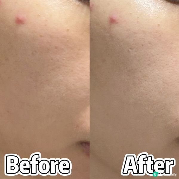 麗珠蘭舒敏凍齡系列✨  退紅保濕，肌膚重拾光澤！