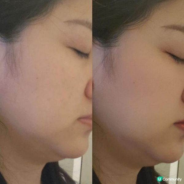 Skintific 5X Ceramide 保濕 gel💦