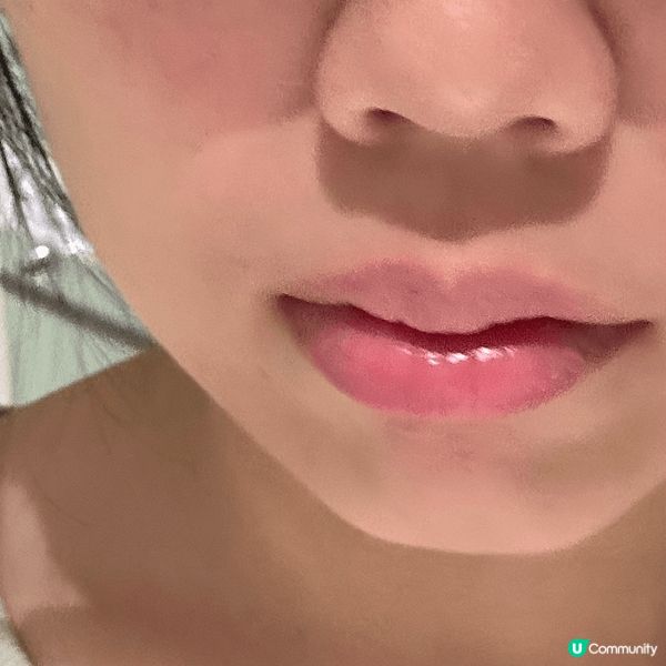 男朋友成日話我包包面, 影相唔夠V面, 但出去做一次Hifu...