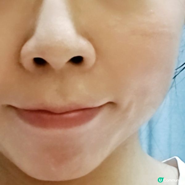 敏感肌救星！💚積雪草面膜