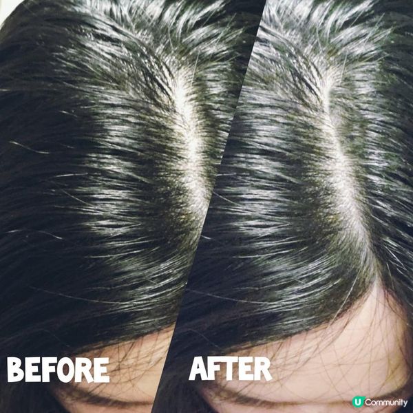 養髮必看！頭髮濃密的秘密武器💫