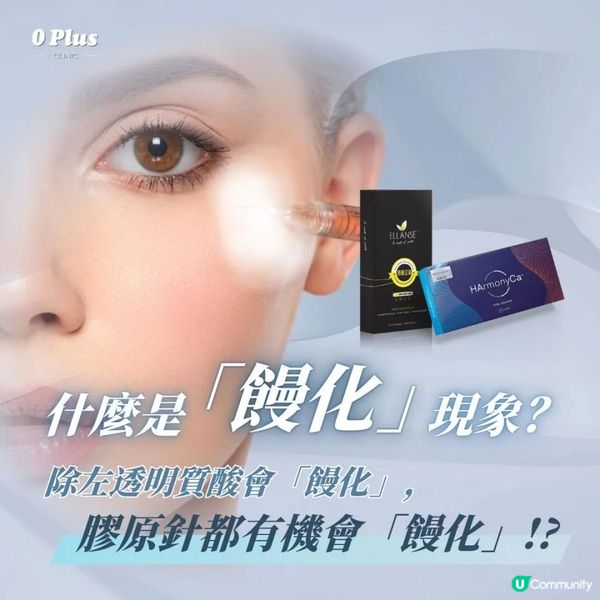 透明質酸填充、少女針Ellansé、美神針HArmonyCA及其他膠原填充物的移位風險專業解析