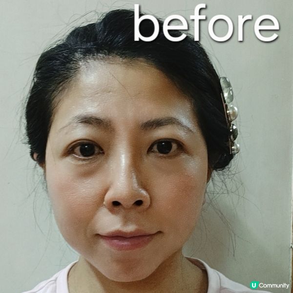 夏日必備！💧抵買透明質酸安瓶推介！✨