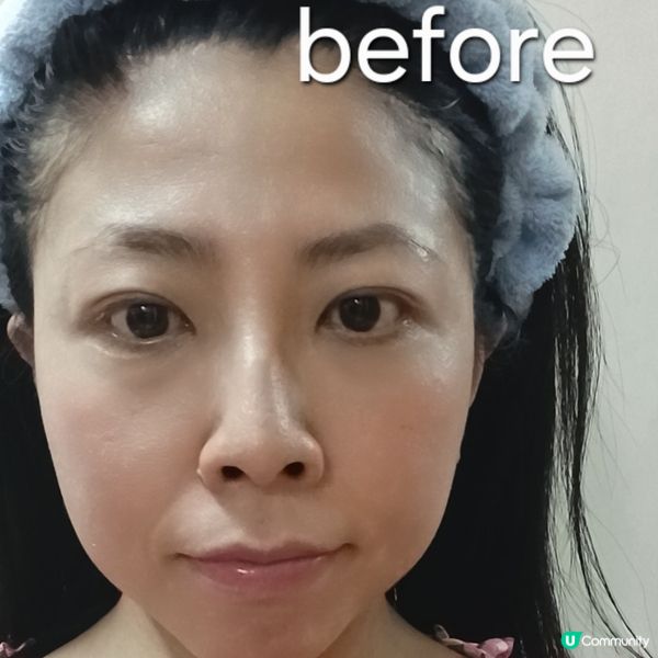 玻尿酸保濕精華一日裝！急救乾燥肌🤩💧 買多更抵！