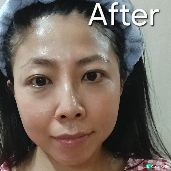 玻尿酸保濕精華一日裝！急救乾燥肌🤩💧 買多更抵！