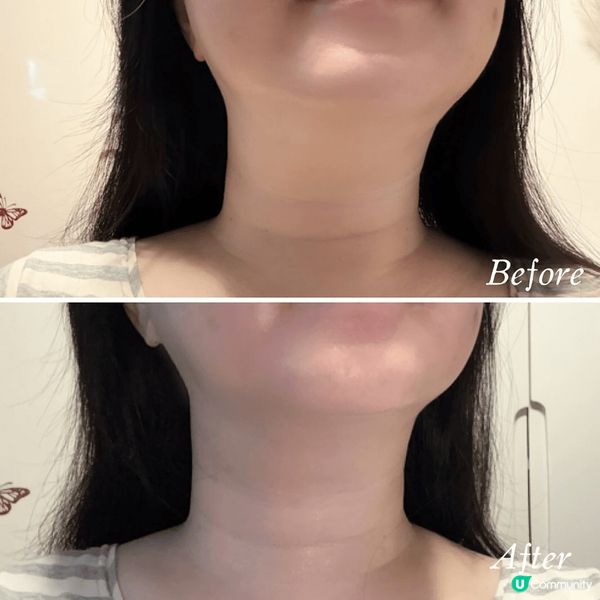 頸紋救星！🇰🇷 逆齡頸膜實測！🤩 