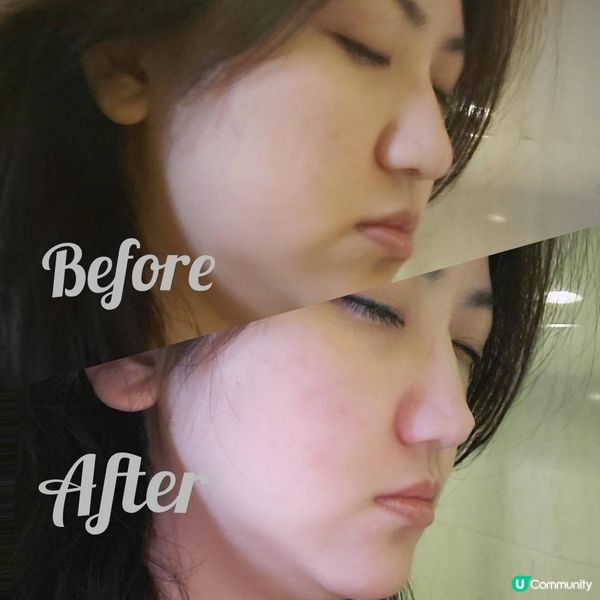 🌞今個夏天，白白滑滑就靠薇諾娜