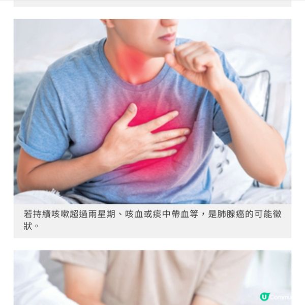 33歲柯煒林肺腺癌第四期腫瘤科醫生: 療法躍進存活期大大延長