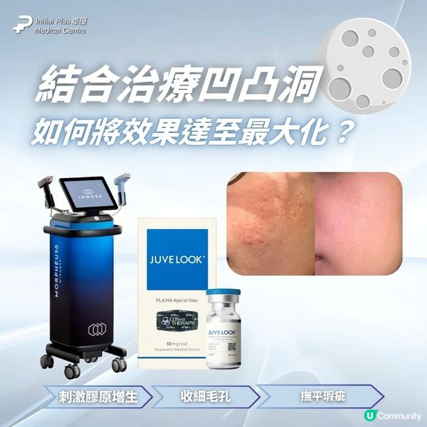 InMode Morpheus 8 與 Juvelook 素顏針：打造無瑕肌膚的痘疤終極療法