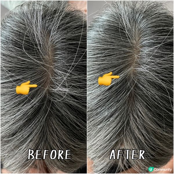 光療生髮帽初體驗！😎 告別掉髮！