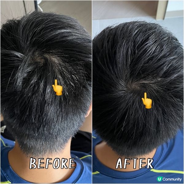 光療生髮帽初體驗！😎 告別掉髮！