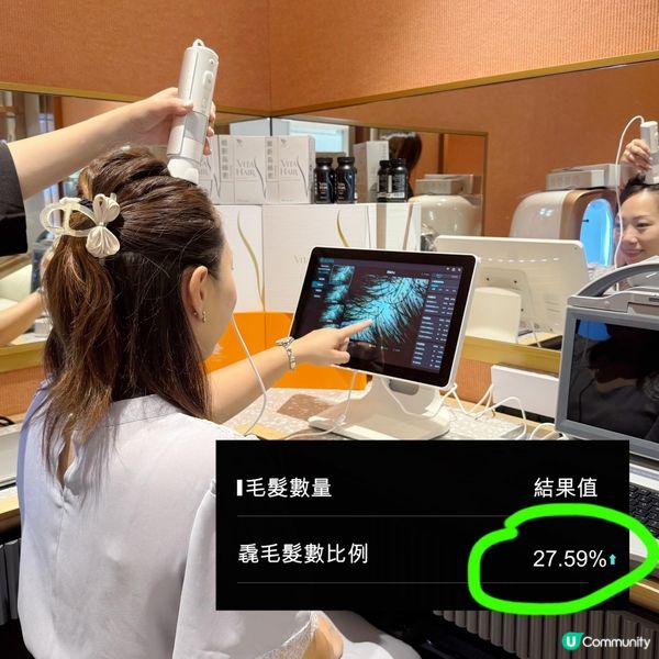 產後脫髮救星！頭髮濃密返晒嚟！🥳