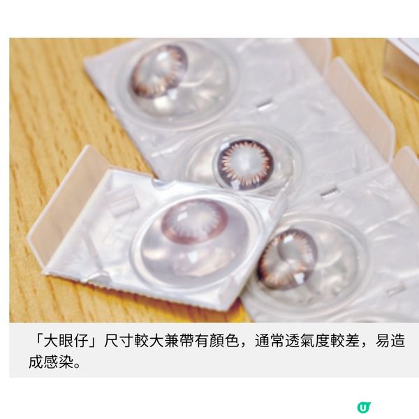 貪靚戴水貨「大眼仔」感染風險高 年輕個案戴Con過夜視力永久