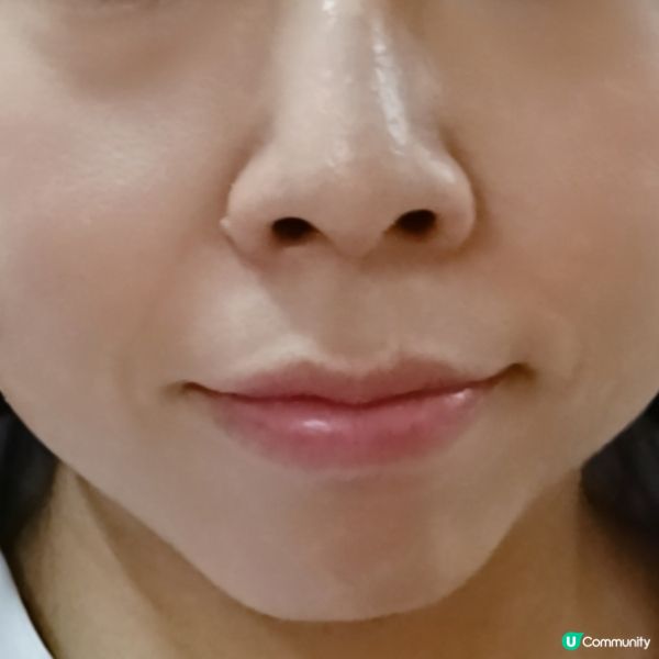 水嫩透亮✨！微生態精華拯救暗沉肌！