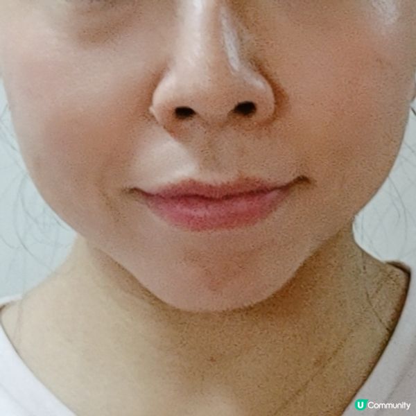 皇家蜂王膠囊雙11預購！✨ 減淡細紋必備！