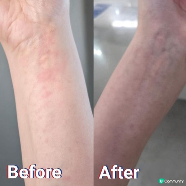 樂道龜苓救膚舒