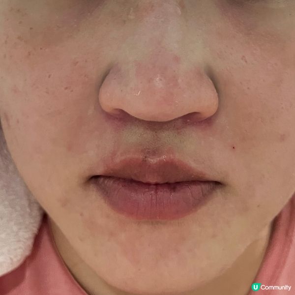Dermafirm 醫療級急救爽膚棉