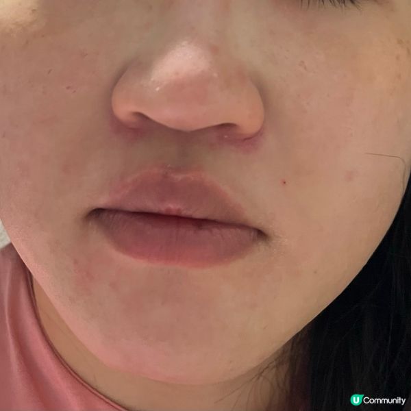 Dermafirm 醫療級急救爽膚棉