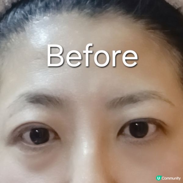 逆齡蛇毒眼膜👁️✨緊緻淡紋