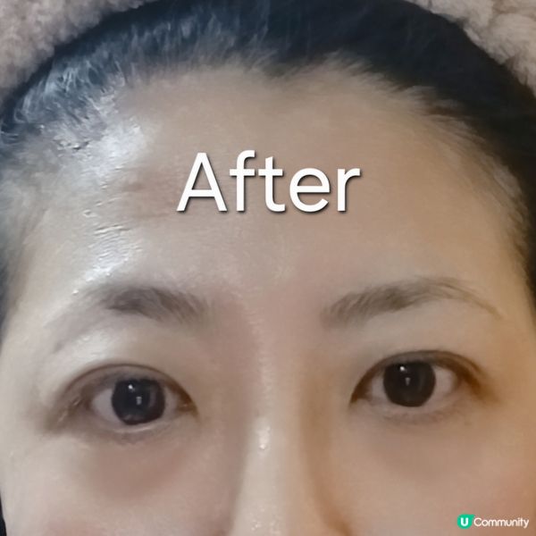 逆齡蛇毒眼膜👁️✨緊緻淡紋