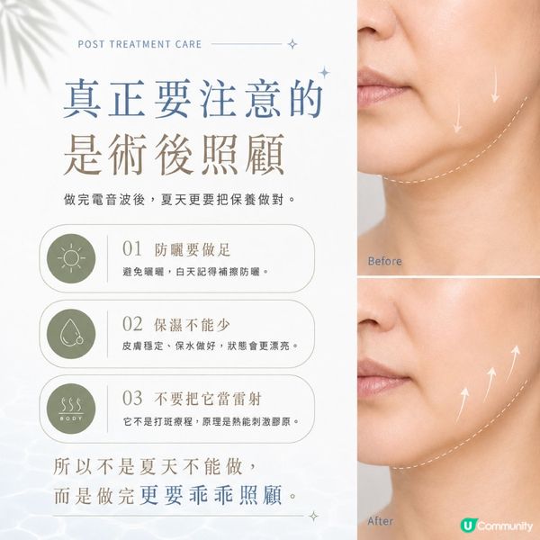夏天打電音波，唔怕反黑！☀️🏖️