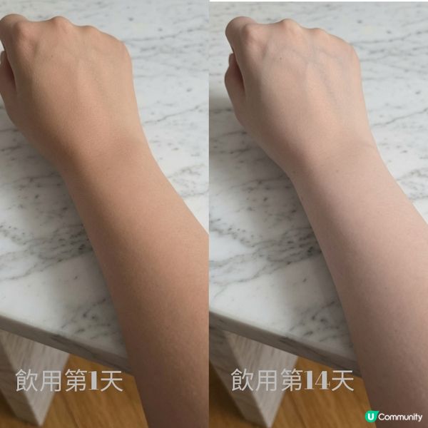 面黃暗沉OUT！🙅‍♀️ skin🌟 ✨