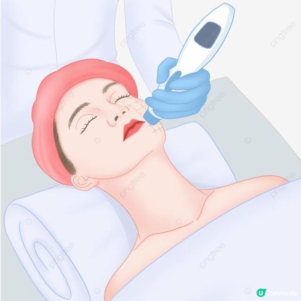 Profhilo逆時針到底系咪玻尿酸？生物重塑劑屬性全解析！