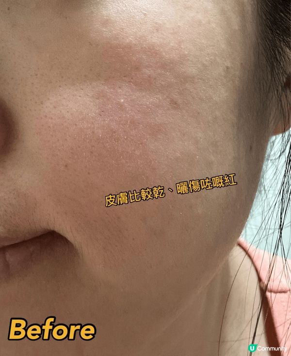 今次介紹喺Snow Fox - 北極微風速效急救面膜，非常之...