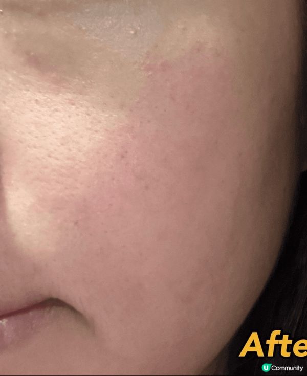 今次介紹喺Snow Fox - 北極微風速效急救面膜，非常之...