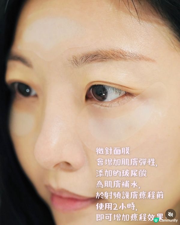 實測大熱家用微針美容🤍最貼近美容院級數