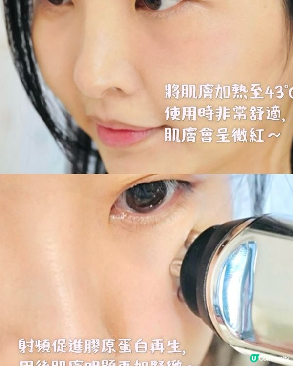 實測大熱家用微針美容🤍最貼近美容院級數