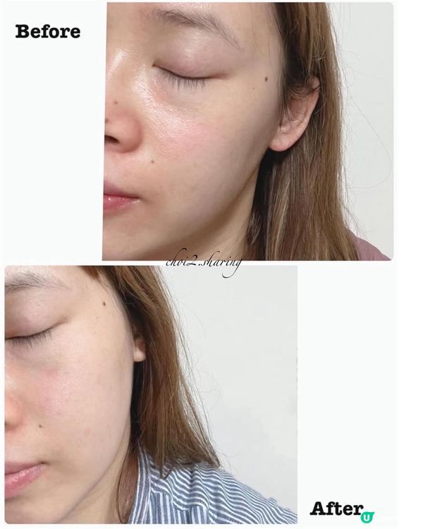 👶🏻媽媽必備！逆齡神器✨ Kiehl's醫學淡紋緊緻再生精華