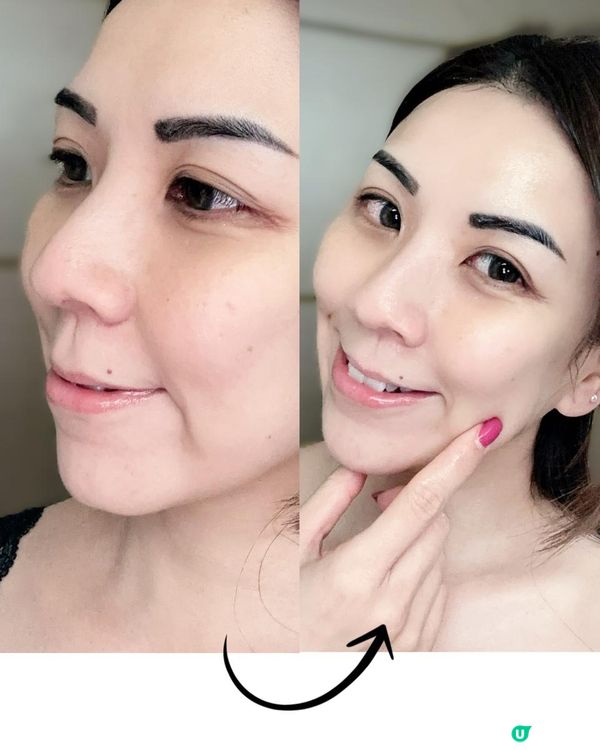 回購之選 ♥ 一敷容光煥發！►韓國Anua PDRN面膜