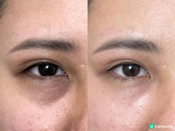 Eye Glow 救了我的千年黑眼圈眼袋🐼｜Eye Glow好唔好？