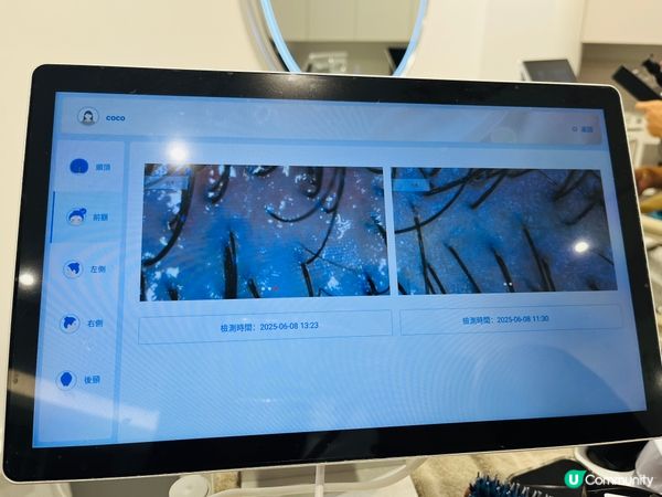 台北初生生頭皮護理初體驗！🤩