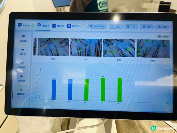 台北初生生頭皮護理初體驗！🤩