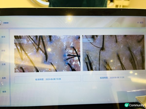 台北初生生頭皮護理初體驗！🤩