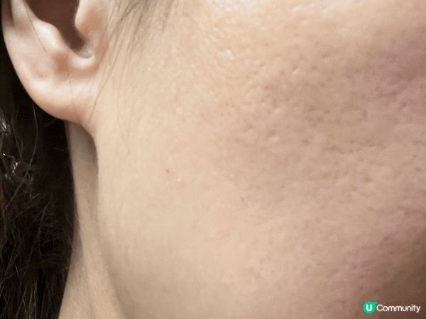 Cetaphil 呢個品牌大家應該唔會陌生，因為佢係美國皮膚...