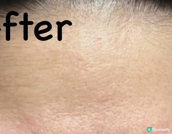 小妹私心推介！護膚孖寶 - Innisfree 綠茶透明質酸...