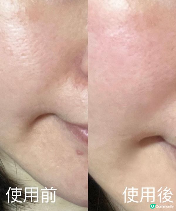 #貴婦級日本精華面霜