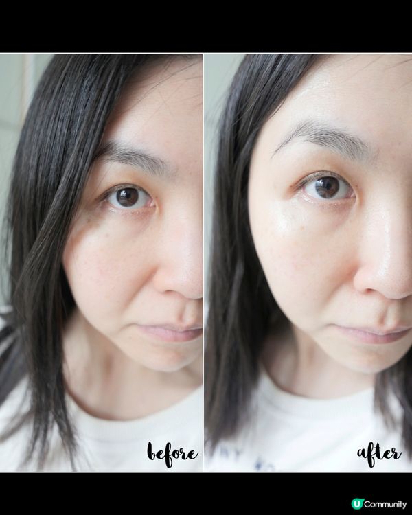 瑞士醫美科研級外泌體精華 🧬  
家用微針逆齡神器