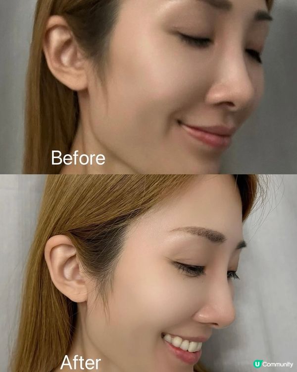 Gulsha日夜玫瑰精華油 🌹