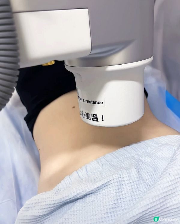 養康中醫館嘅AI艾灸機器人🤖腰痛即日消除